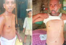 बलिया के 315 गांवों के ढाई लाख लोगों की नसों में घुला आर्सेनिक, चर्मरोग और सांसों पर भी संकट